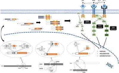 NTRK Fusions and TRK Inhibitors: Potential Targeted Therapies for Adult Glioblastoma